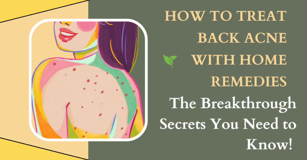 How to Treat Back Acne with Home Remedies: The Breakthrough Secrets You Need to Know!