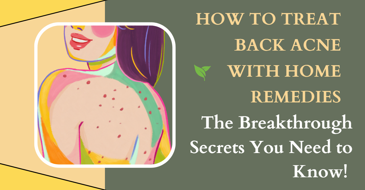 How to Treat Back Acne with Home Remedies
