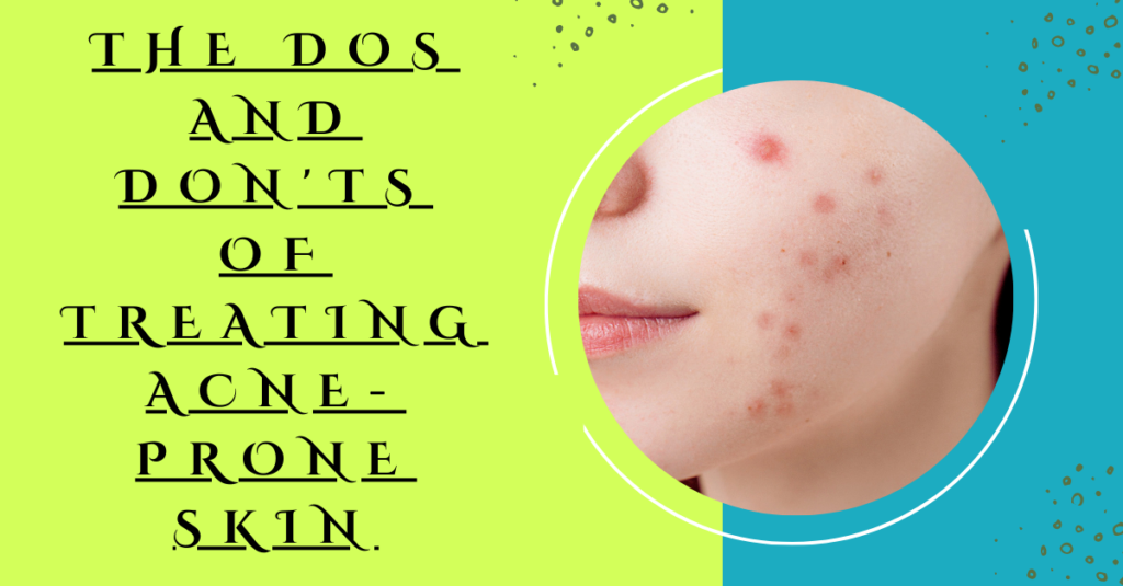 The Dos and Don'ts of Treating Acne-prone Skin